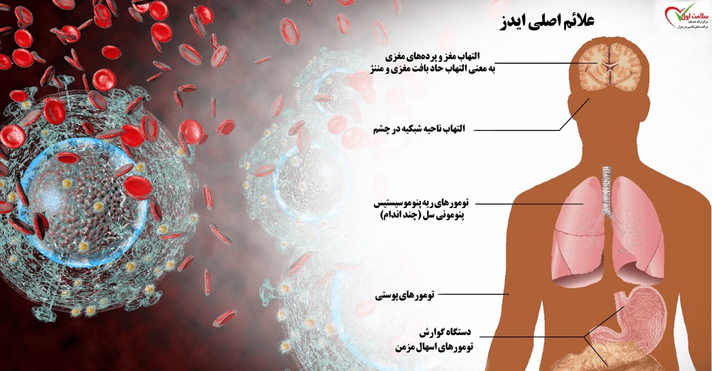 علائم ایدز در مردان و زنان