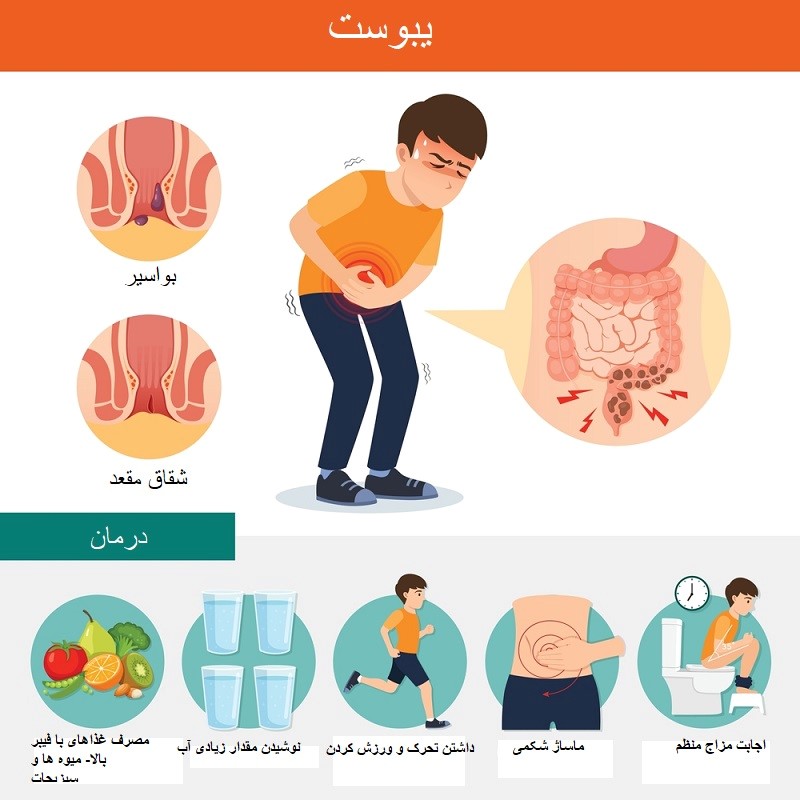 علل بواسیر