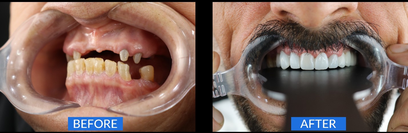 دندانپزشکی زیبایی