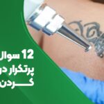 12 سوال مهم و پرتکرار درباره پاک کردن تاتو