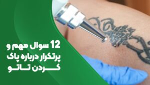 12 سوال مهم و پرتکرار درباره پاک کردن تاتو