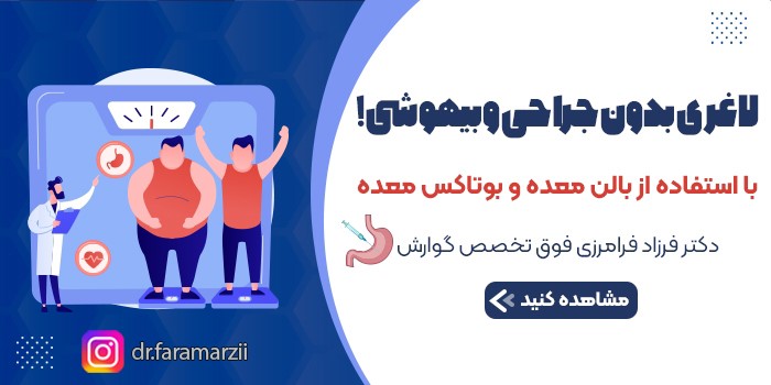 بوتاکس معده، یک روش سریع لاغری و کاهش وزن توسط دکتر فرزاد فرامرزی