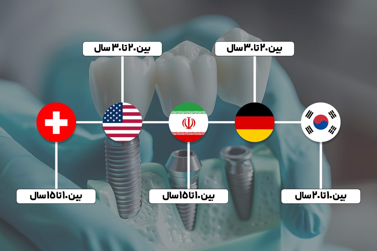 طول عمر برندهای معتبر ایمپلنت دندان 