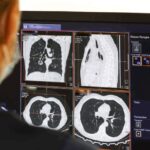 چگونه متوجه سرطان شویم و اقدامات پس از آن