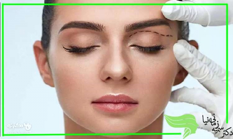 بهترین سن برای عمل جراحی افتادگی پلک بلفاروپلاستی