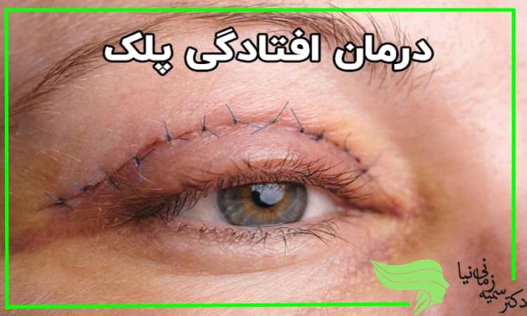 بهترین روش دائمی خداحافظی با افتادگی پلک