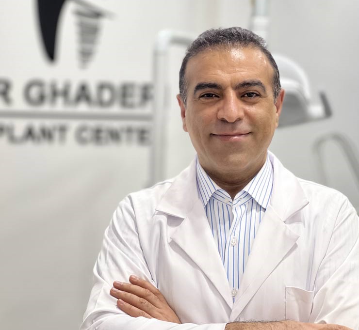 ایمپلنت همه دندانها 