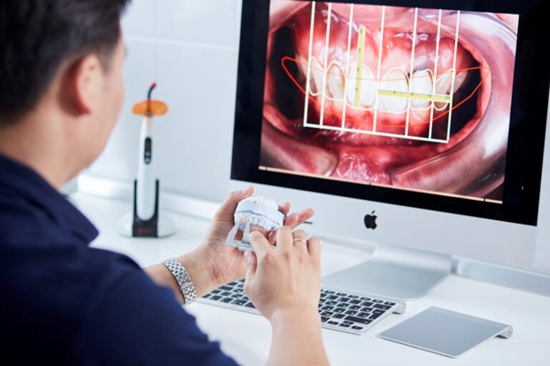 کاشت-ایمپلنت-فوری-یک-روزه 
