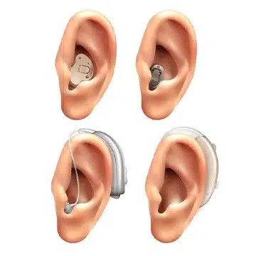 بهترین کلینیک شنوایی سنجی و گفتار درمانی در تهران