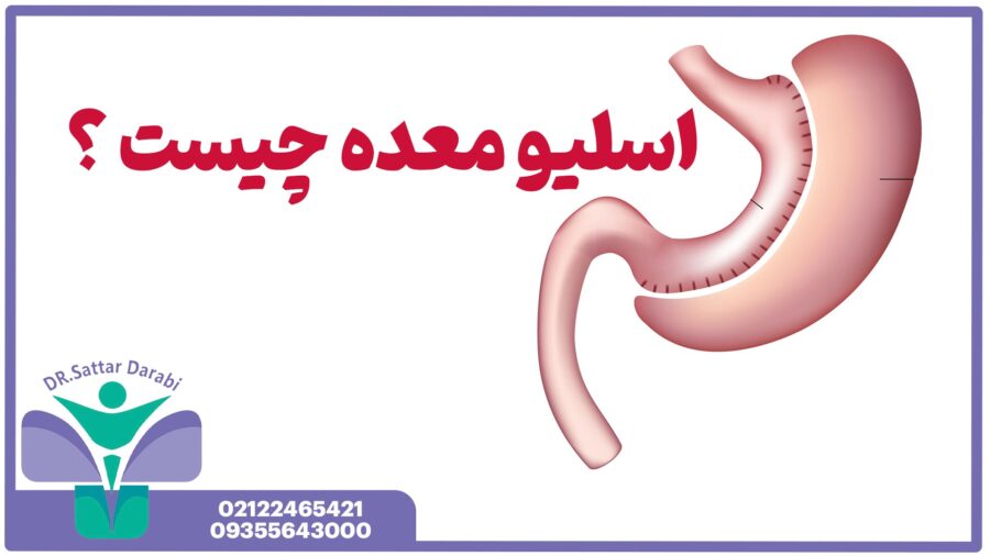 عمل اسلیو معده چیست؟ بررسی جامع جراحی محبوب لاغری