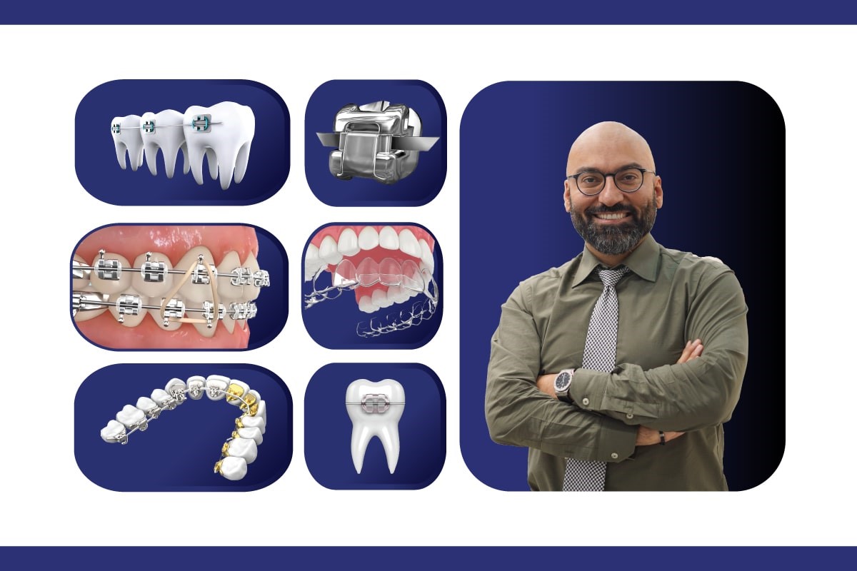 صفر تا صد ارتودنسی دندان | معرفی بهترین متخصص ارتودنسی تهران