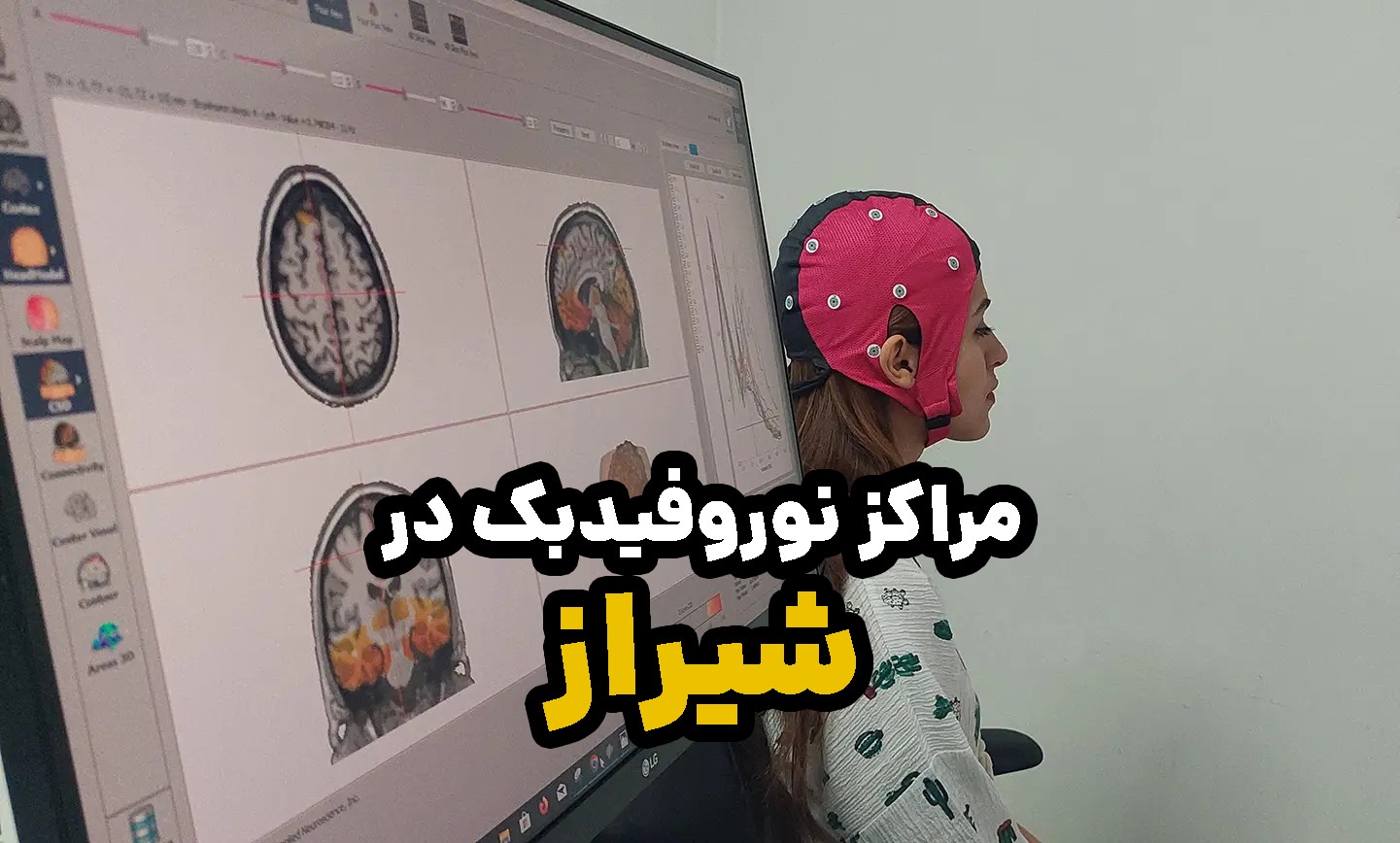 نگاهی علمی به نوروفیدبک در شیراز با تمرکز بر فناوری‌های نوین