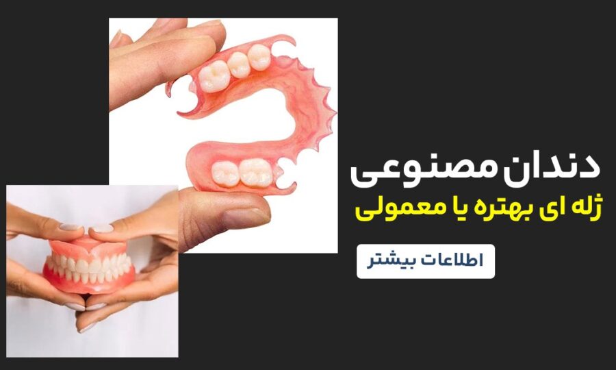 دندان مصنوعی ژله ای بهتره یا معمولی 