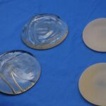 جراحی پروتز سینه و مراقبت های قبل و بعد از آن