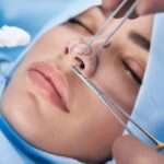 هزینه جراحی بینی؛ راهنمای کامل برای تصمیم درست