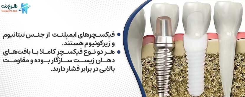 انواع فیکسچرهای ایمپلنت بر اساس جنس