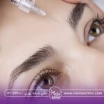 بهترین آمپول های جوانساز صورت چیست؟