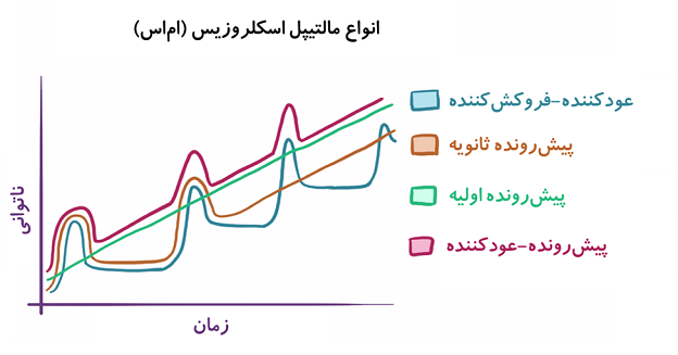 انواع ام‌اس