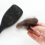 برای درمان ریزش مو دقیقاً چه کنیم؟ راهنمای کامل از تشخیص تا درمان تخصصی