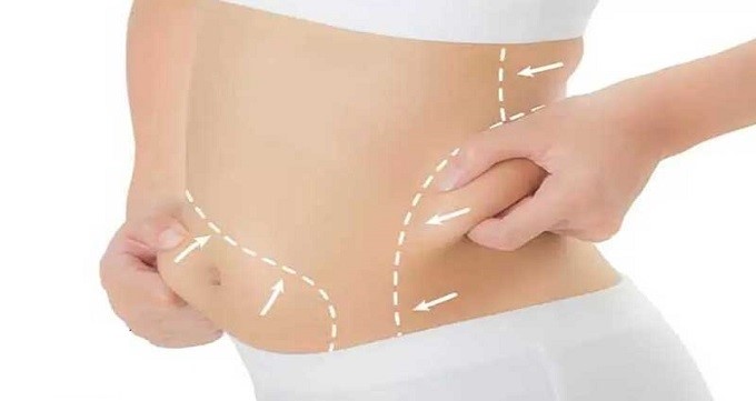 مزایای کلیدی لیپوماتیک نسبت به سایر تکنیک‌های لاغری