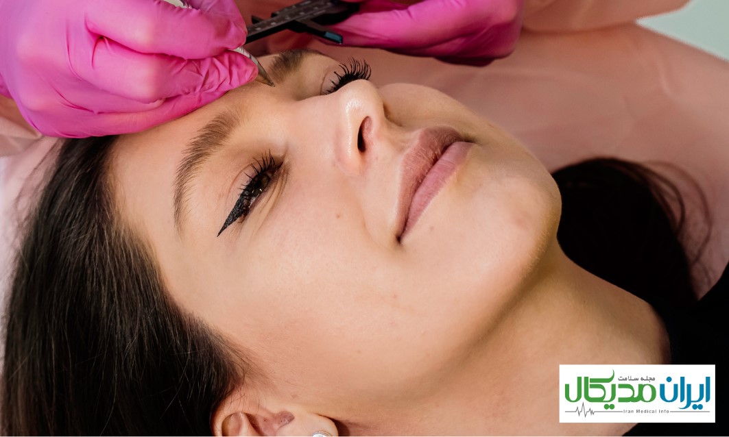 کلینیک کاشت ابرو در مشهد