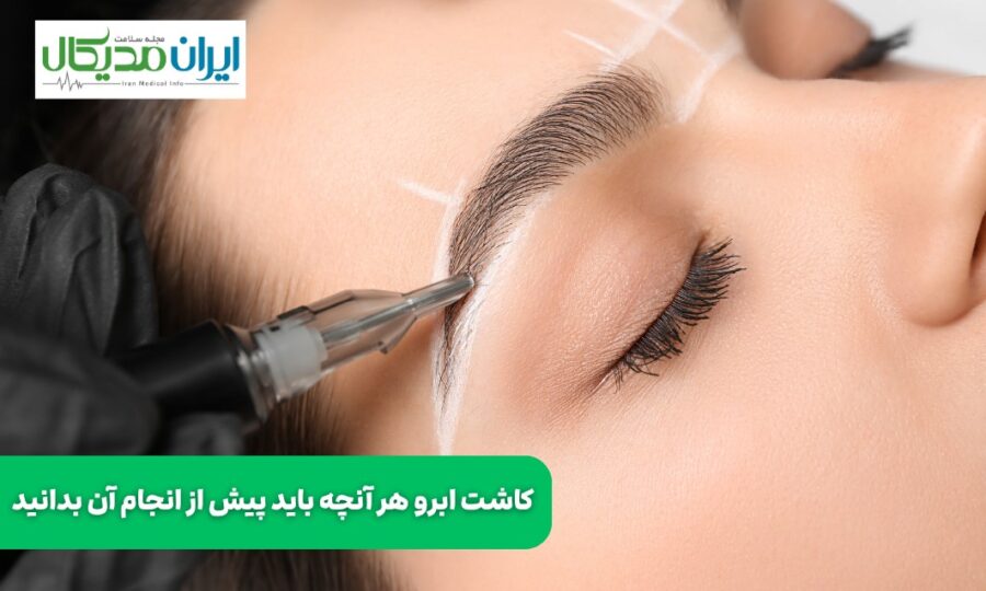  کاشت ابرو هر آنچه باید پیش از انجام آن بدانید