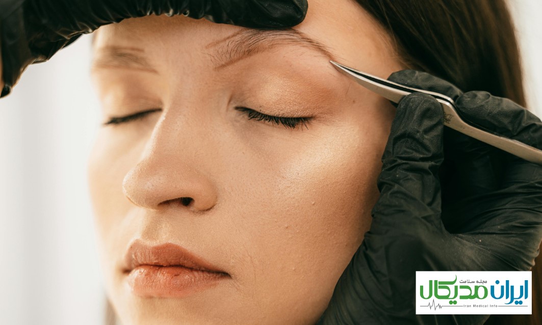 دکتر خوب برای کاشت ابرو در مشهد