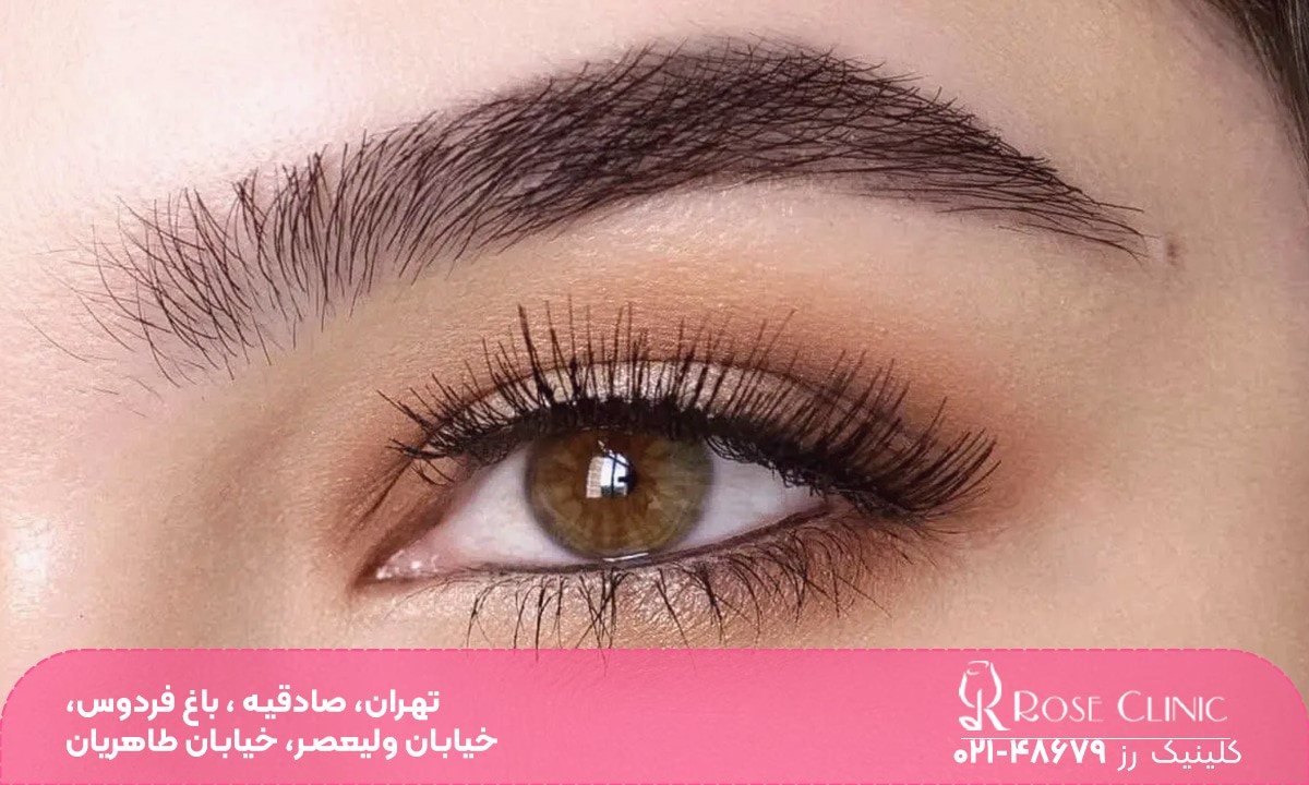 هزینه کاشت ابرو در سال 1404 چقدر است؟