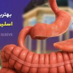 معرفی دکتر متخصص اسلیو معده در شیراز 