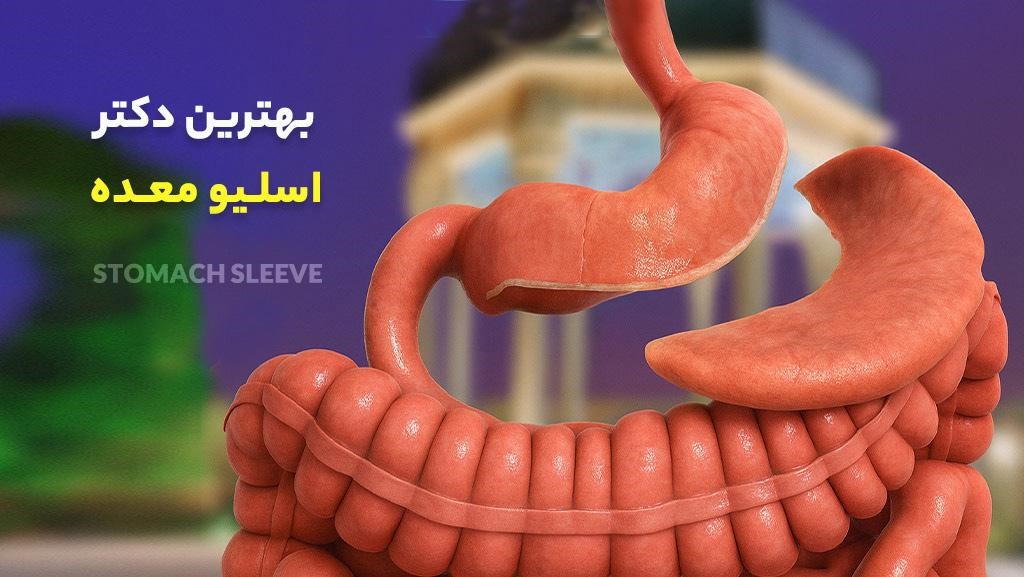معرفی دکتر متخصص اسلیو معده در شیراز 