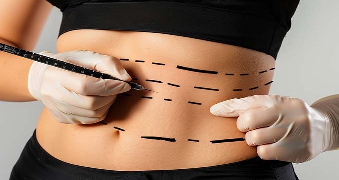 7 مزیت مهم لیپوماتیک نسبت به سایر روش های لاغری【سال1404】❤️