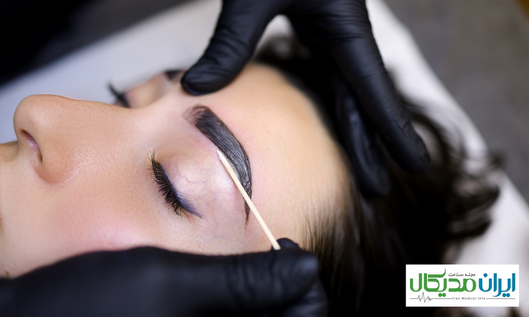 بهترین دکتر کاشت ابرو در مشهد