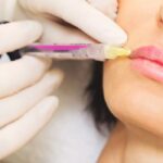 چرا چهره نگار انتخاب اول زیباجویان در تزریق فیلر، بوتاکس و کاشت ابرو است؟