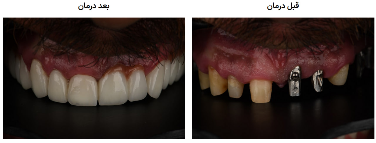 دندانپزشکی تحت بیهوشی در کرج
