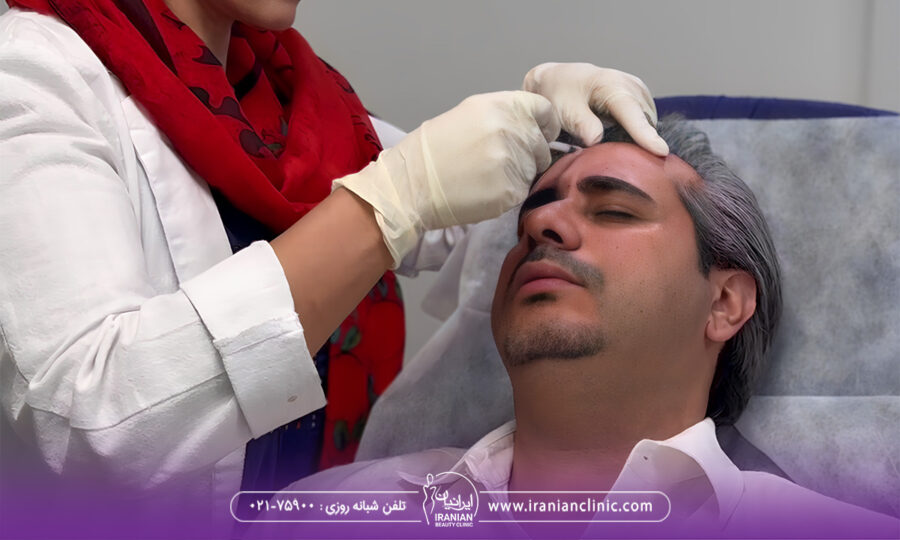 ۵ نشانه که زمان بوتاکس شما رسیده است!