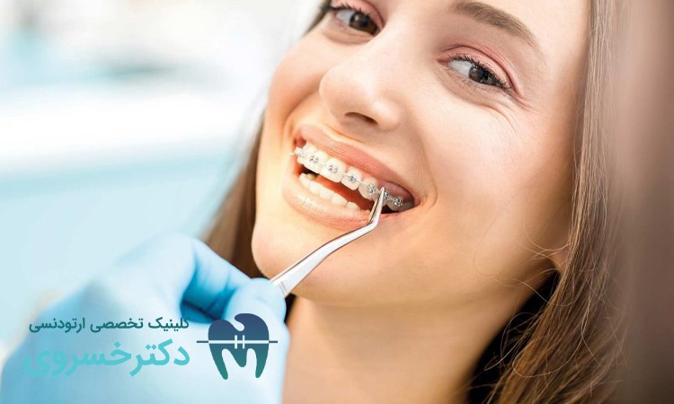 ارتودنسی روشی باارزش برای مرتبی دندان
