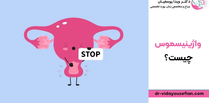 واژینیسموس