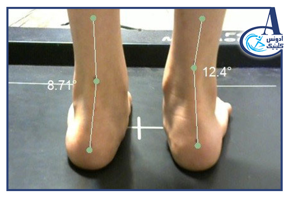 انواع مختلف دستگاه‌های اسکن کف پا و ویژگی‌های تکنولوژیکی
