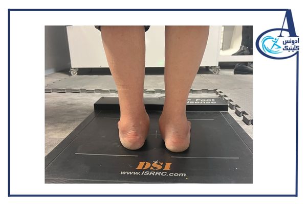 مفهوم کلی و تعریف اسکن کف پا