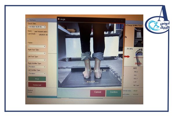 اسکن کف پا چیست و چه کسانی به آن نیاز دارند؟ [راهنمای کامل ۱۴۰۴]