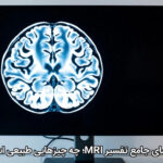 راهنمای جامع تفسیر MRI؛ چه چیزهایی طبیعی است؟