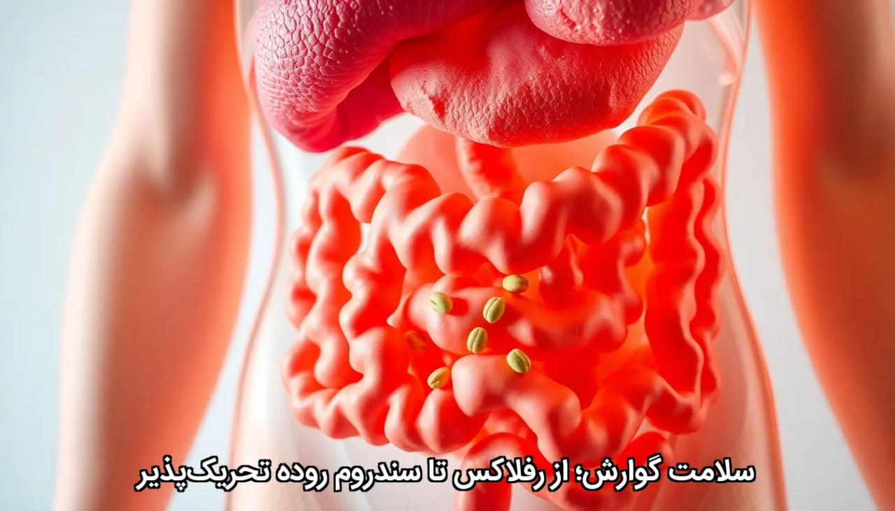 سلامت گوارش؛ از رفلاکس تا سندروم روده تحریک‌پذیر