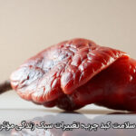 سلامت کبد چرب؛ تغییرات سبک زندگی مؤثر