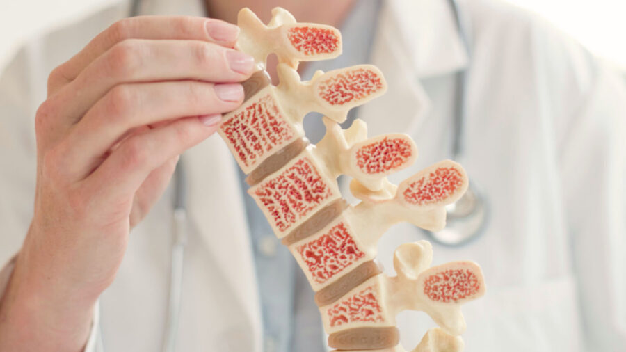 پیشگیری از پوکی استخوان در خانم‌ها