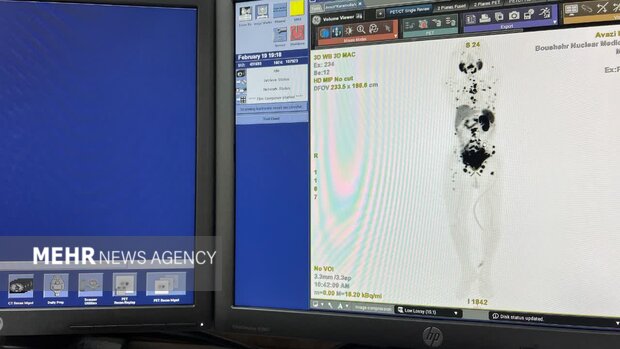 افزایش امید بیماران سرطانی به درمان؛ شکوفایی پزشکی هستهای در بوشهر افزایش امید بیماران سرطانی به درمان؛ شکوفایی پزشکی هستهای در بوشهر