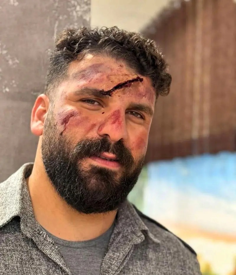 حادثه‌ی تلخ برای بلاگر معروف اینستاگرامی / سقوط «وضعتان چونه» در کوهستان