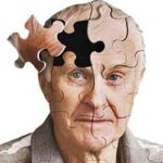 درمان سریع آسیب سر، خطر ابتلا به آلزایمر را کاهش می‌دهد