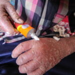 لزوم شفافیت بودجه‌ای انجمن‌های حمایت از بیماران