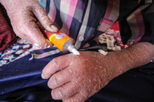 لزوم شفافیت بودجه‌ای انجمن‌های حمایت از بیماران