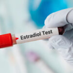 همه چیز در مورد آزمایش استرادیول (estradiol)